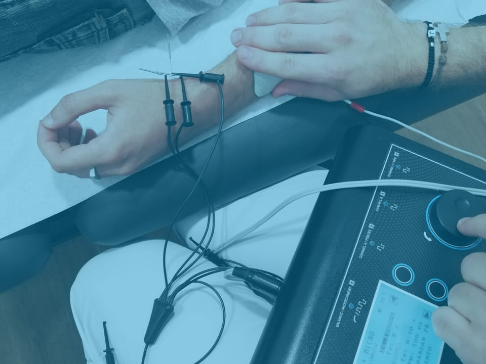 tratamiento de electrólisi con EPTE